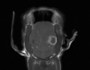 X-Ray of Thea's Brain