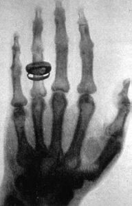 x-ray image