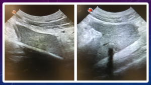 The ultrasound scan showing the kebab skewer in Teddy’s spleen
