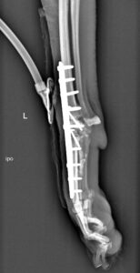 3 days post-op with NPWT