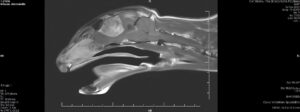MRI scan