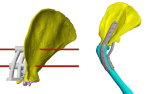 Images of the aiming devices created by Vet3D for Genghis’s operation.