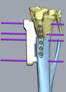 Customized bone concept with pins
