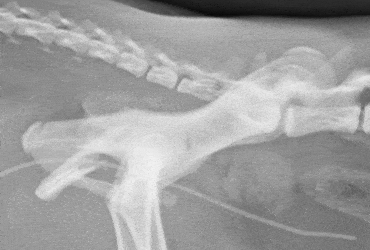 Conservative Management of Pelvic Fractures