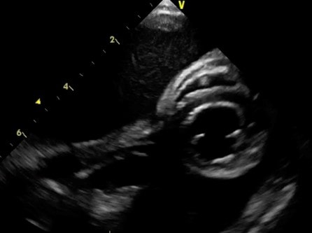 ultrasound1 tips experts