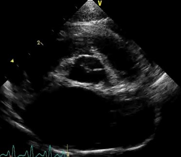 ultrasound2 tips experts