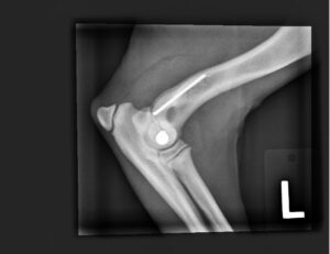 X-rays Showing The Damage to Alfie’s Humerus