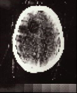 old ultrasound image